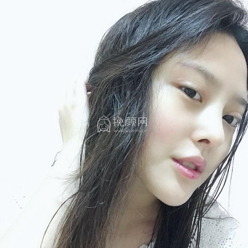 北京美莱王旭东做鼻子*果怎么样？