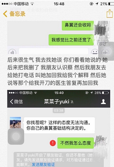 工作室做的耳软骨垫鼻尖，假体隆鼻和鼻翼缩小