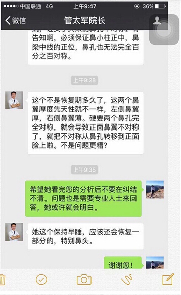 工作室做的耳软骨垫鼻尖，假体隆鼻和鼻翼缩小