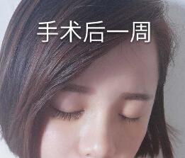 在衢州一家医院做的*