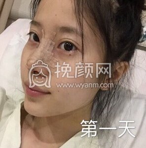 上海喜美徐文龙医生做的*