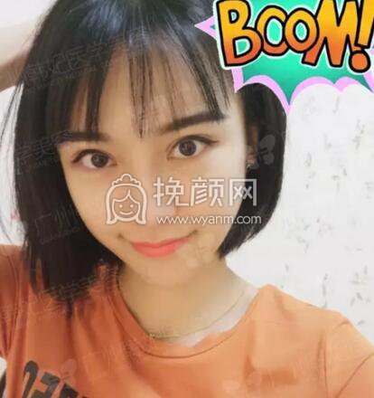 广州韩妃医疗美容真人案例