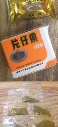 厦门第一医院的殷佳鹏医生做的全切双眼皮