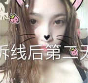 河南郑州美莱医院张主任做的全切+内眼角