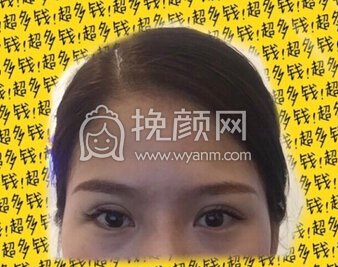 武汉美嘉医疗整形美容医院杨斐院长精切