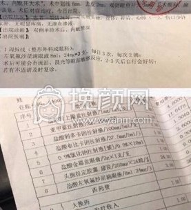 上海周一雄全切双眼皮+眼角