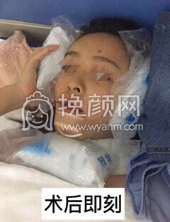 武汉美立方美容医院胡文亚脂肪填充和下巴修复