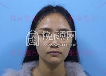 长沙雅美真人测评  十分钟肌肤迅速回春，冬季保