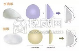 隆胸假体怎么正确选择