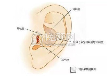 武汉协和整形钟爱梅医生做耳软骨隆鼻*果怎么