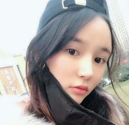 杭州华山连天美整形医生刘军鼻部多项案例分享