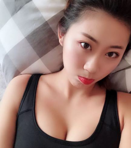 北京美莱医疗美容假体隆胸*果怎么样？