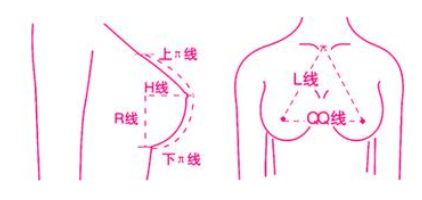 自体脂肪隆胸你真的了解吗？