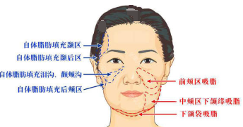 深圳美莱整形医院怎么样？