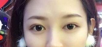 沈阳杏林美容整形医院做双眼皮怎么样？