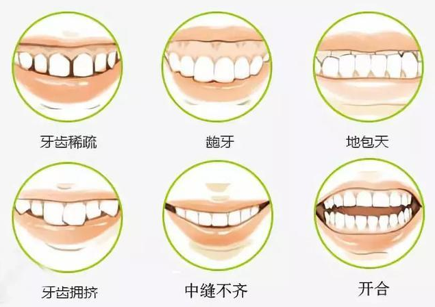 靖江北极星口腔医院张海瀚做牙齿整形怎么样？