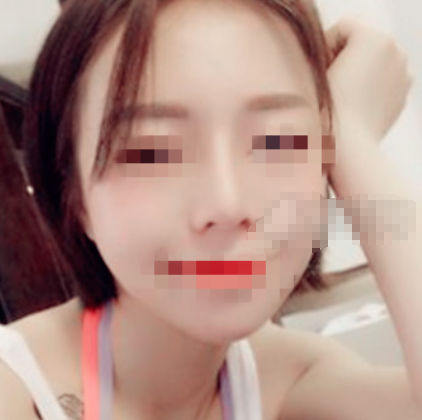 上海容妍李昕隆鼻怎么样 失败多吗？