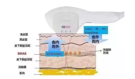 脸部的*和眼部的热玛吉多少钱？