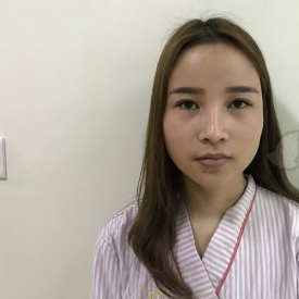 广州可玫尔医美医生刘喆骐鼻修复案例分享