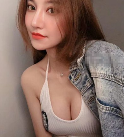 广州美莱李高峰假体隆胸咋样？案例附图分享