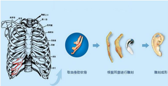 广州高尚医疗整形美容景丽峰做*怎么样？